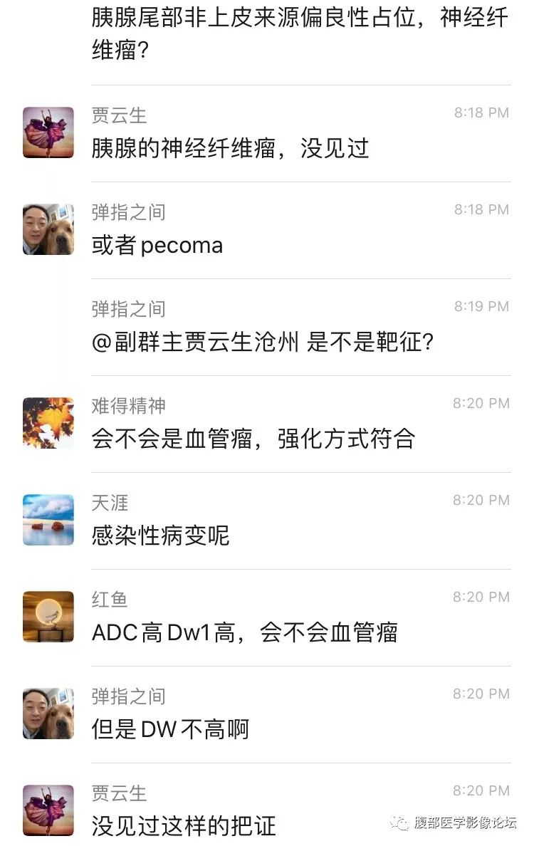 【病例】胰尾局灶性慢性胰腺炎1例MR影像讨论
