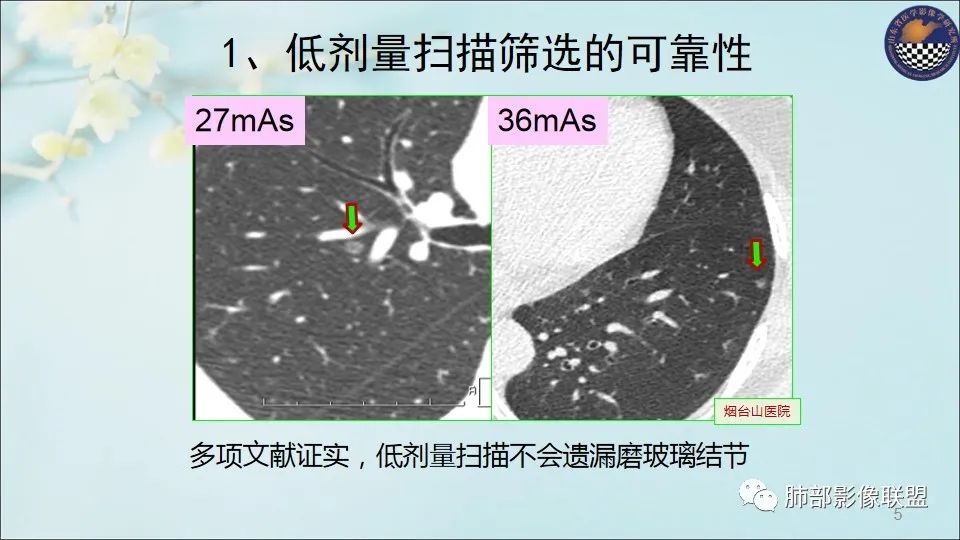 【PPT】重视针对肺GGO的战略转移