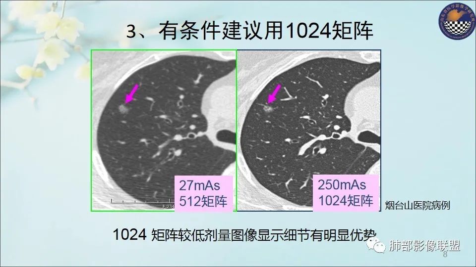 【PPT】重视针对肺GGO的战略转移
