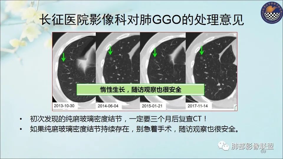 【PPT】重视针对肺GGO的战略转移