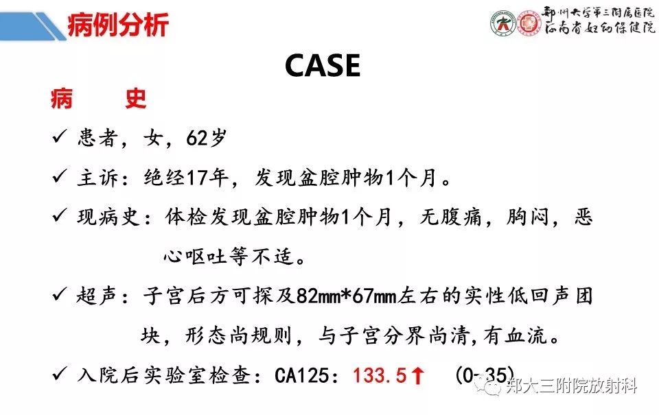 【PPT】卵巢肿瘤的影像诊断思路