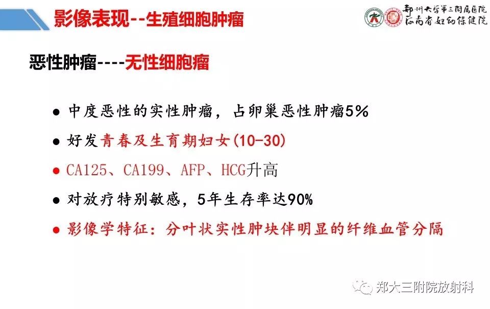 【PPT】卵巢肿瘤的影像诊断思路