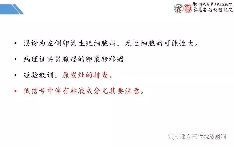 【PPT】卵巢肿瘤的影像诊断思路