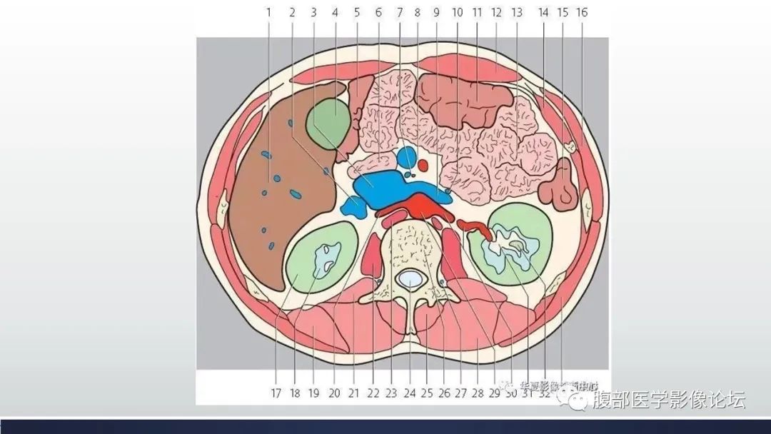 【病例】腹内疝1例CT影像诊断 【病例】腹内疝1例CT影像诊断