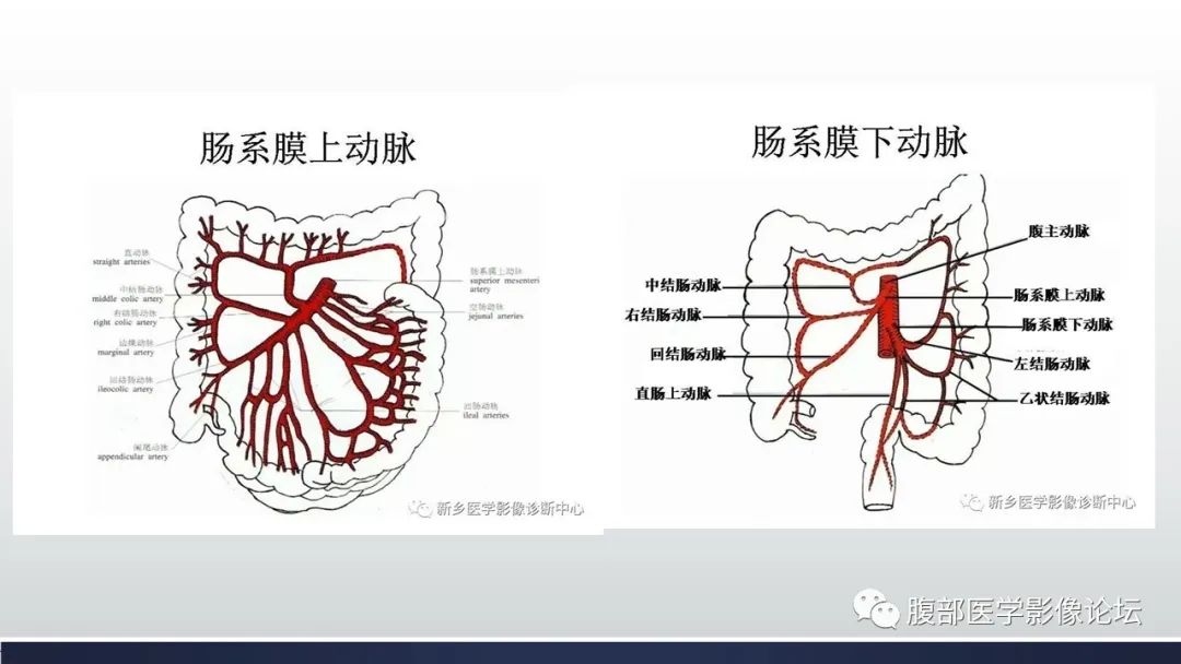 【病例】腹内疝1例CT影像诊断 【病例】腹内疝1例CT影像诊断