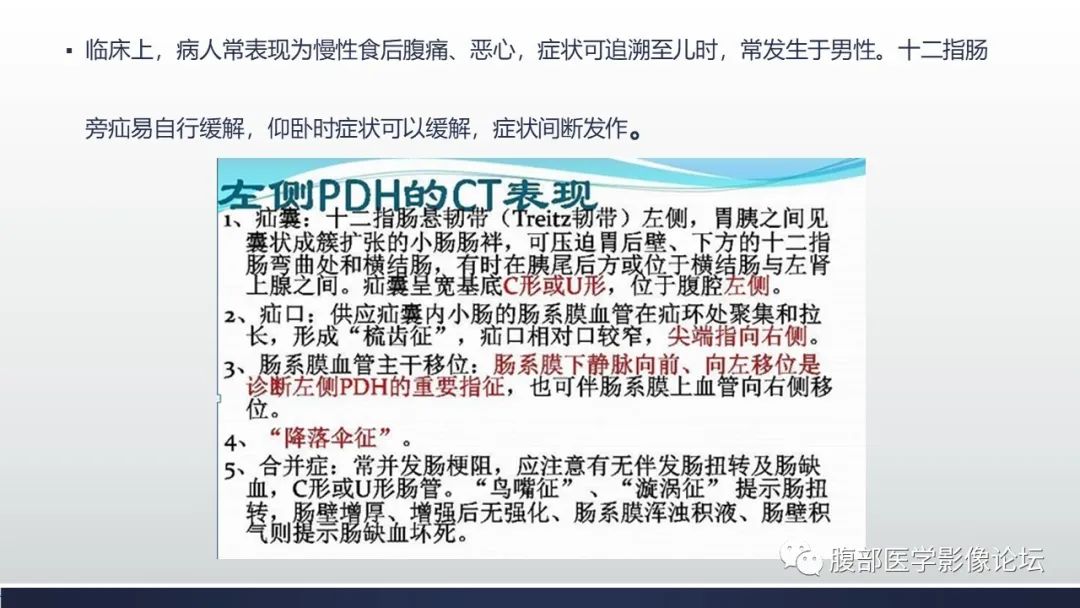【病例】腹内疝1例CT影像诊断 【病例】腹内疝1例CT影像诊断