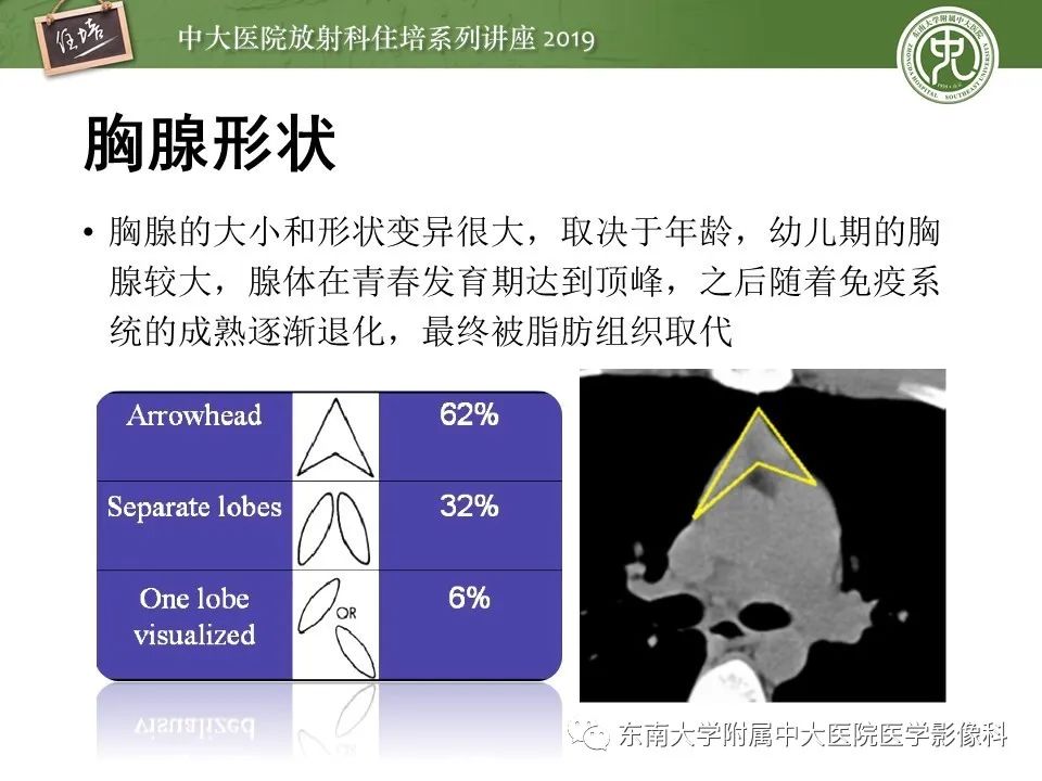 【PPT】胸腺上皮性肿瘤的影像诊断及鉴别