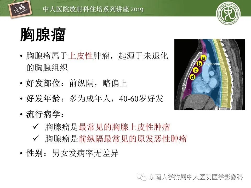 【PPT】胸腺上皮性肿瘤的影像诊断及鉴别