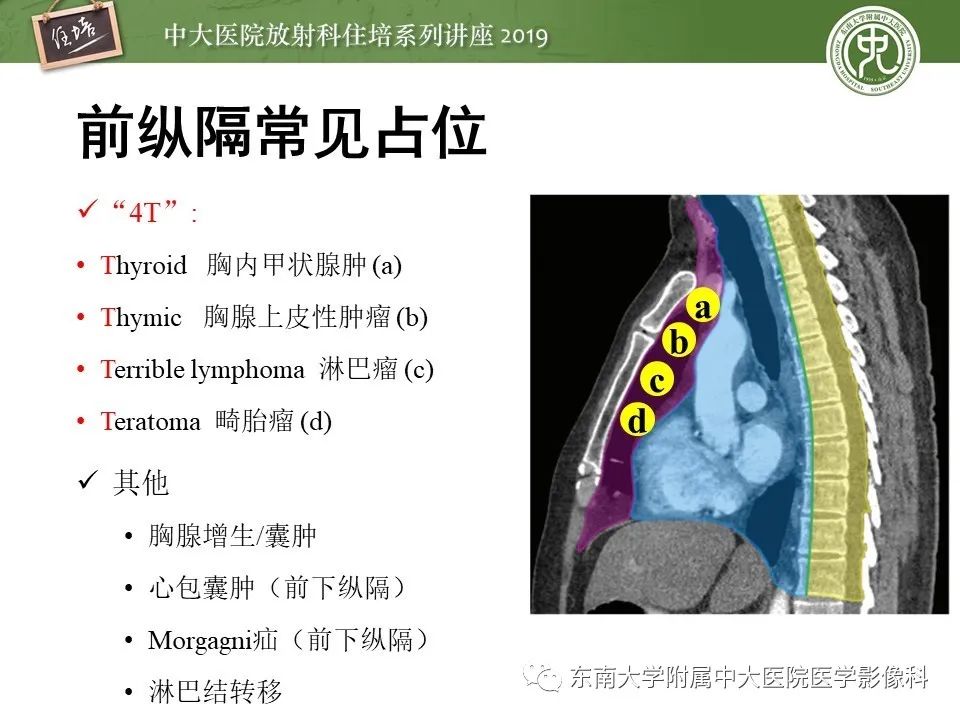 【PPT】胸腺上皮性肿瘤的影像诊断及鉴别
