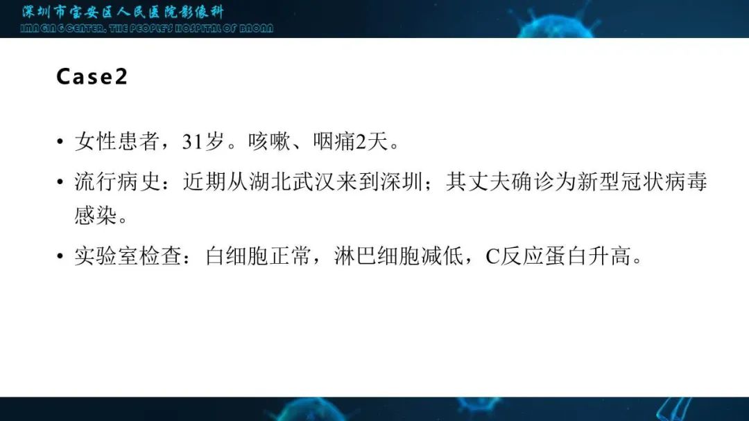 【PPT】输入性新型冠状病毒肺炎早期CT表现