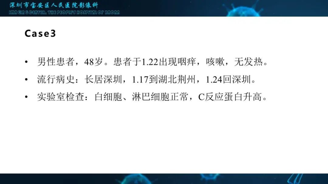【PPT】输入性新型冠状病毒肺炎早期CT表现