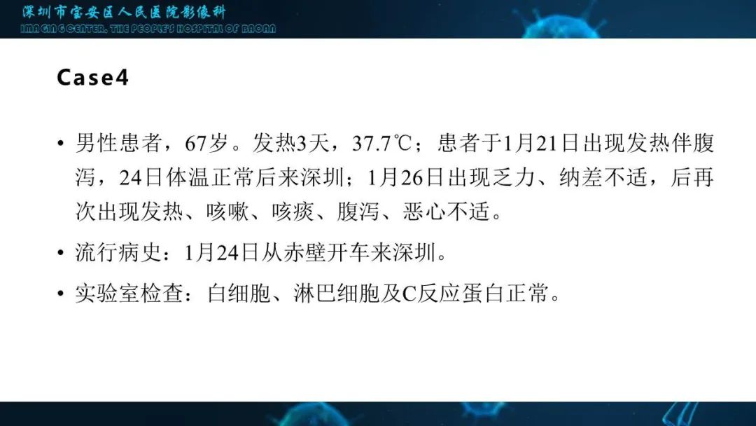 【PPT】输入性新型冠状病毒肺炎早期CT表现