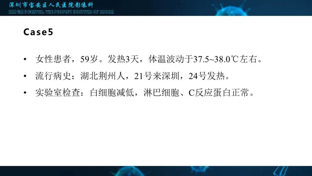 【PPT】输入性新型冠状病毒肺炎早期CT表现
