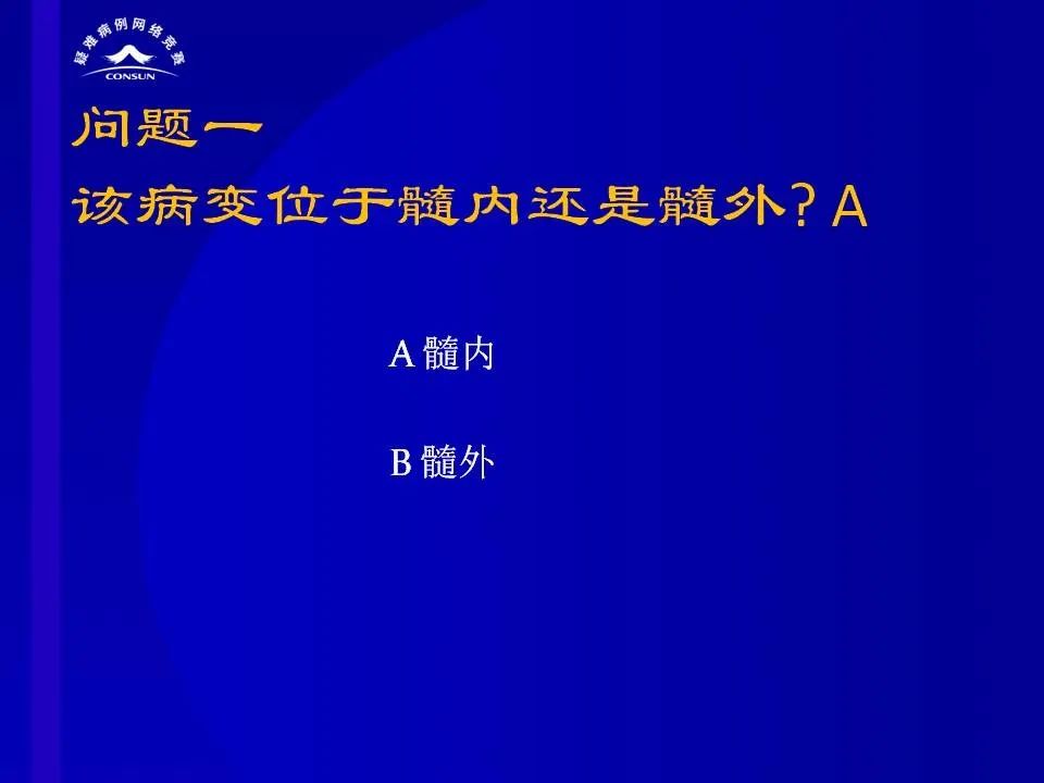 【病例】脊髓节细胞胶质瘤1例MR影像解析