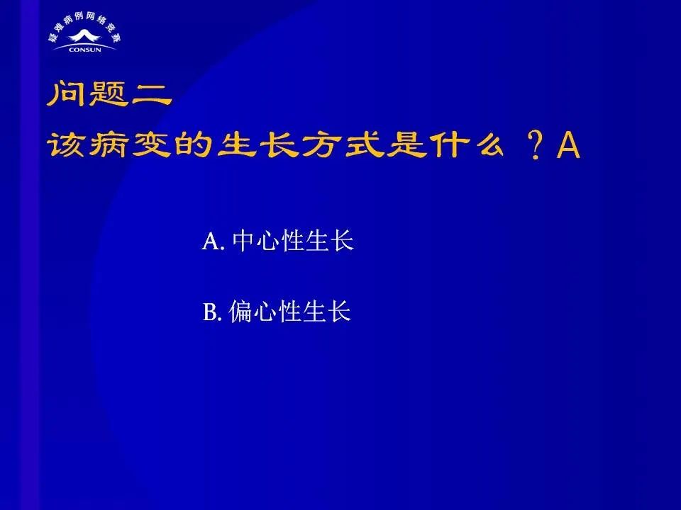 【病例】脊髓节细胞胶质瘤1例MR影像解析