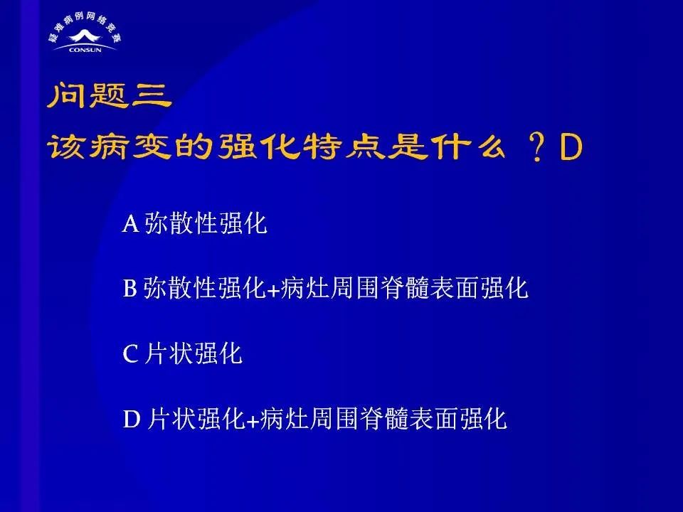 【病例】脊髓节细胞胶质瘤1例MR影像解析