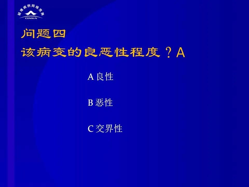 【病例】脊髓节细胞胶质瘤1例MR影像解析