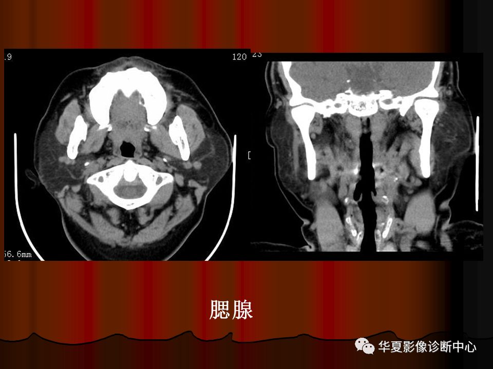 【PPT】口腔颌面部CT诊断