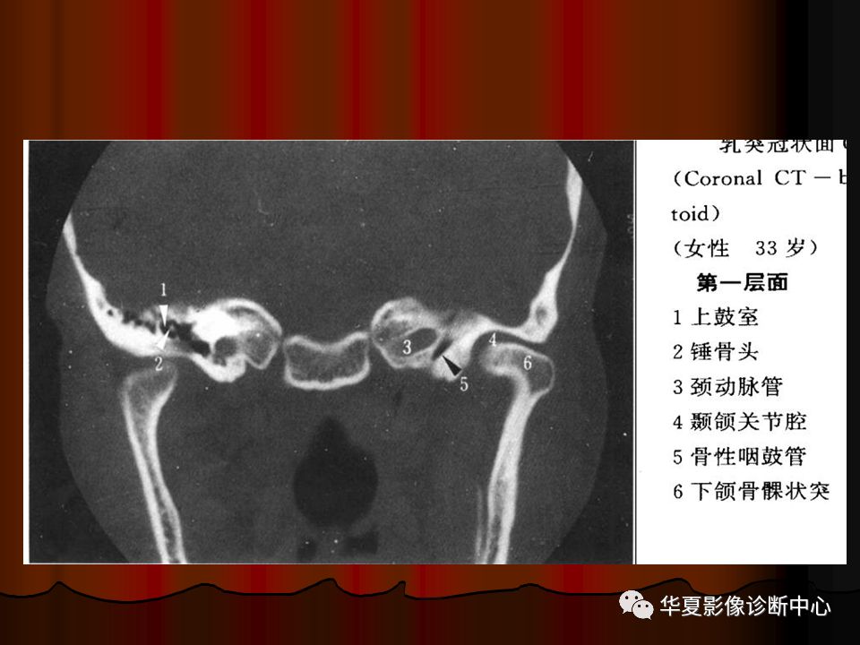 【PPT】口腔颌面部CT诊断