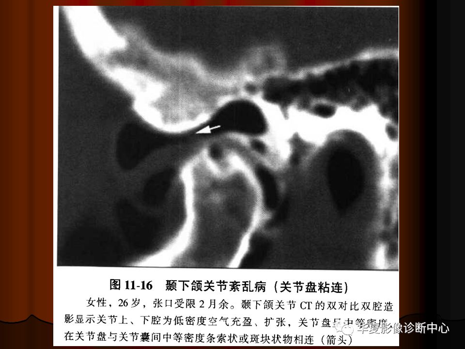 【PPT】口腔颌面部CT诊断