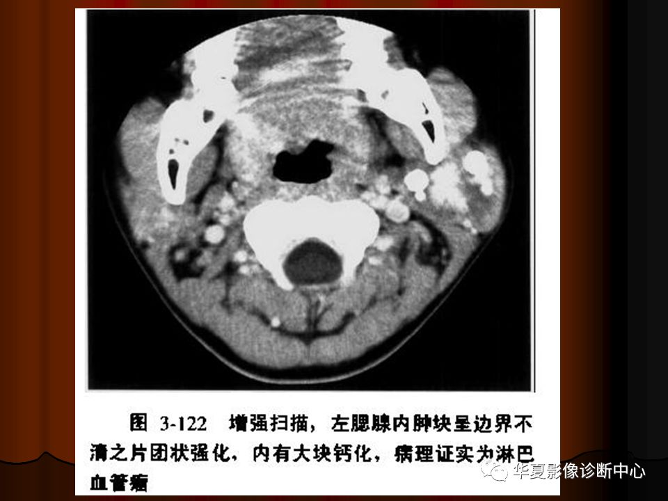 【PPT】口腔颌面部CT诊断
