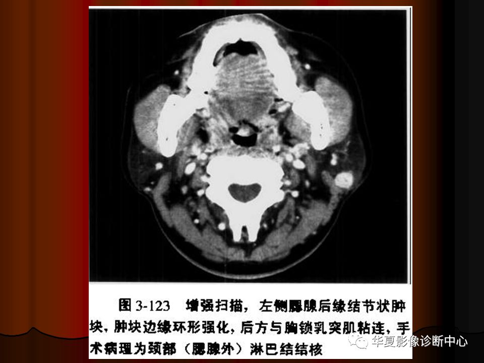 【PPT】口腔颌面部CT诊断