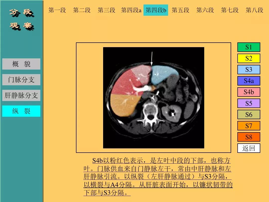肝脏CT断层解剖详解