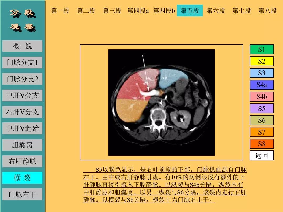 肝脏CT断层解剖详解