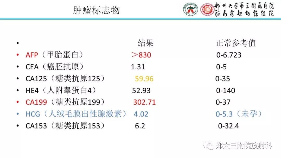 【病例】卵巢未成熟畸胎瘤1例MR影像