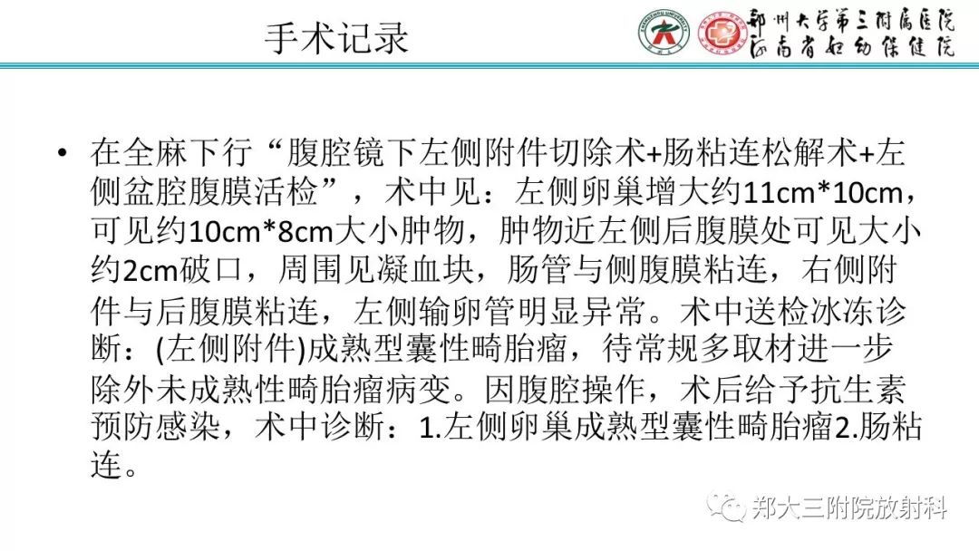 【病例】卵巢未成熟畸胎瘤1例MR影像