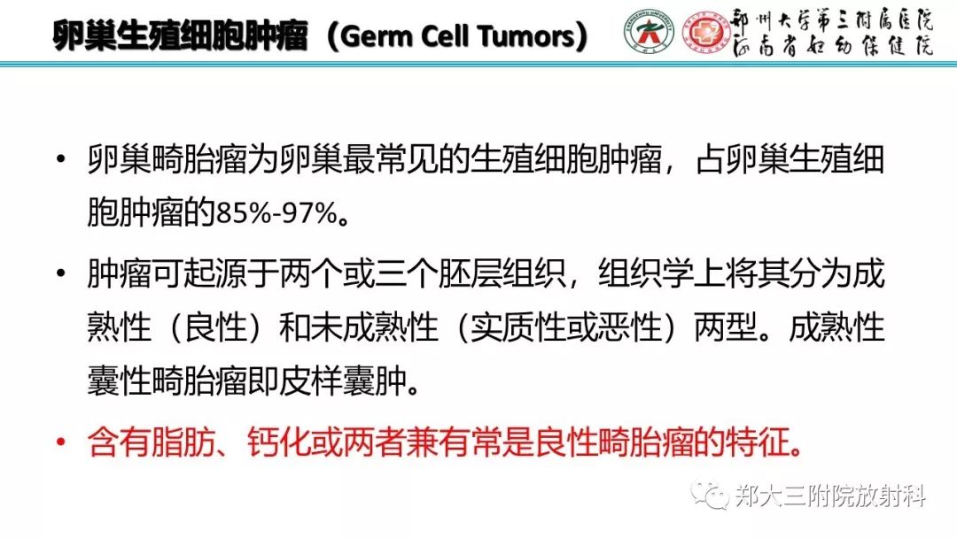 【病例】卵巢未成熟畸胎瘤1例MR影像