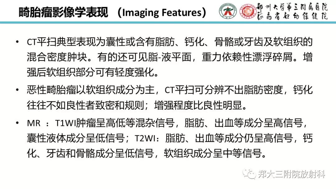 【病例】卵巢未成熟畸胎瘤1例MR影像