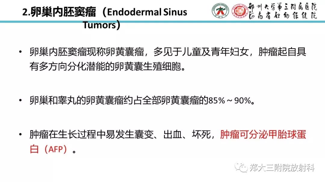 【病例】卵巢未成熟畸胎瘤1例MR影像