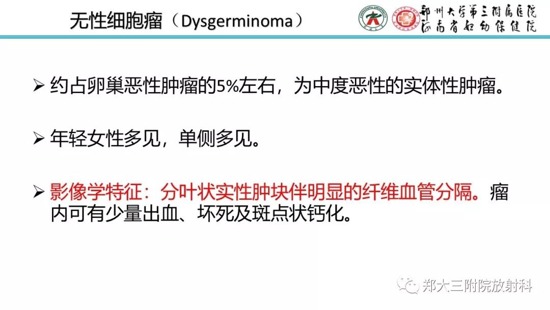 【病例】卵巢未成熟畸胎瘤1例MR影像