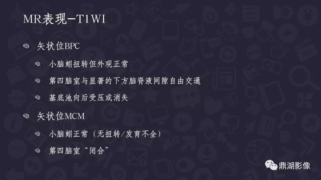 【PPT】DANDY-WALKER