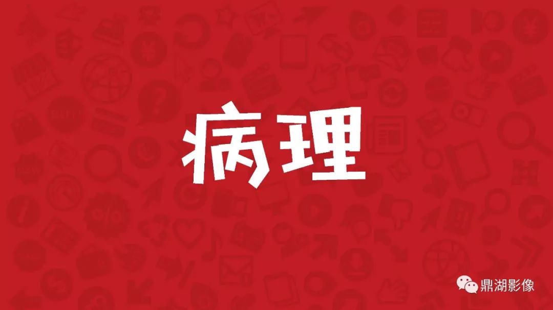 【PPT】DANDY-WALKER
