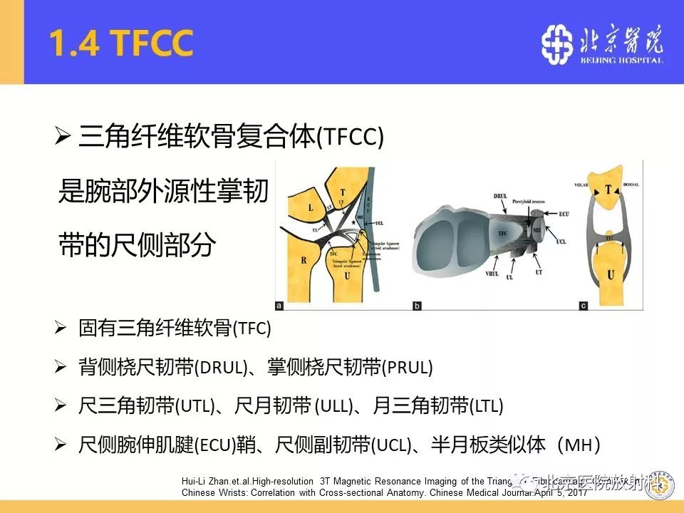 【PPT】三角纤维软骨复合体（TFCC）损伤