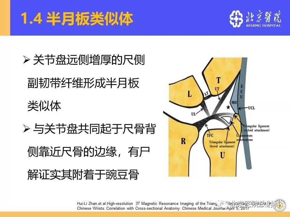 【PPT】三角纤维软骨复合体（TFCC）损伤