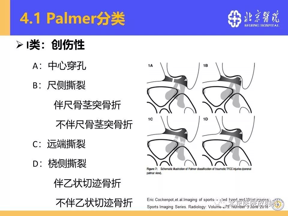 【PPT】三角纤维软骨复合体（TFCC）损伤