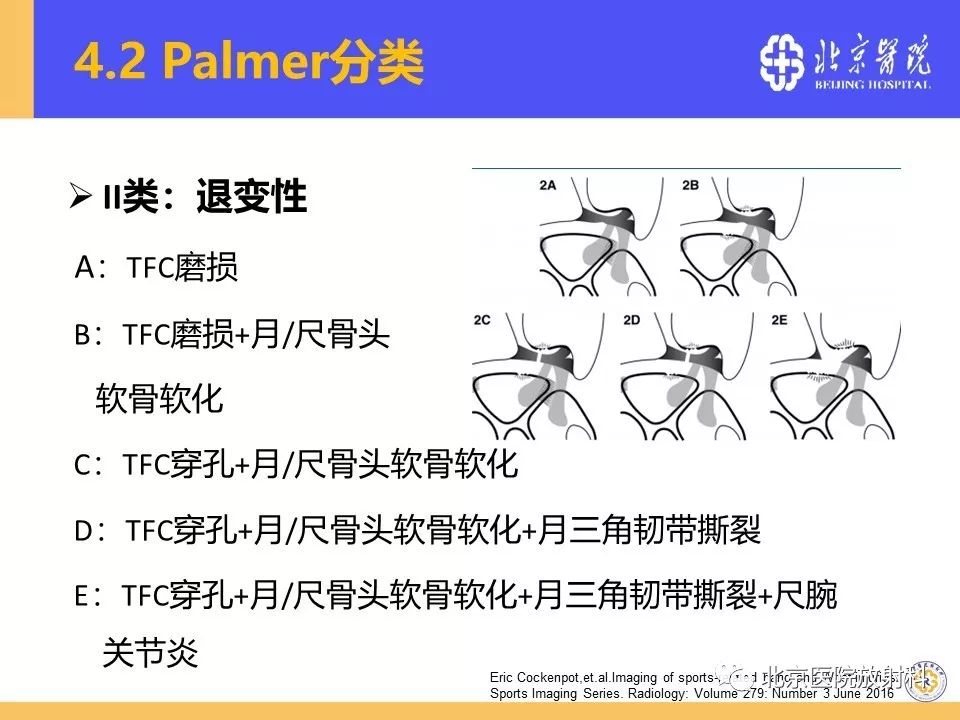 【PPT】三角纤维软骨复合体（TFCC）损伤