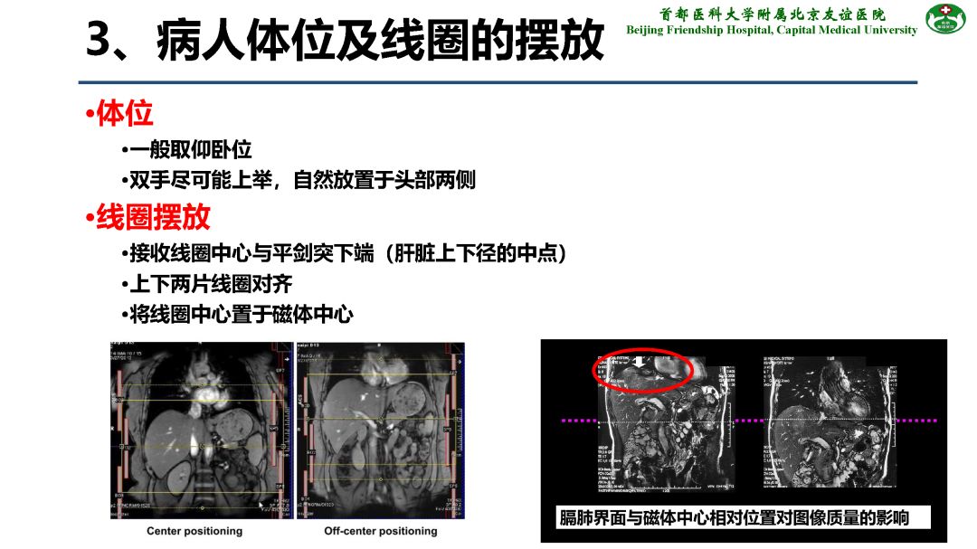 【PPT】肝脏MRI检查技术规范