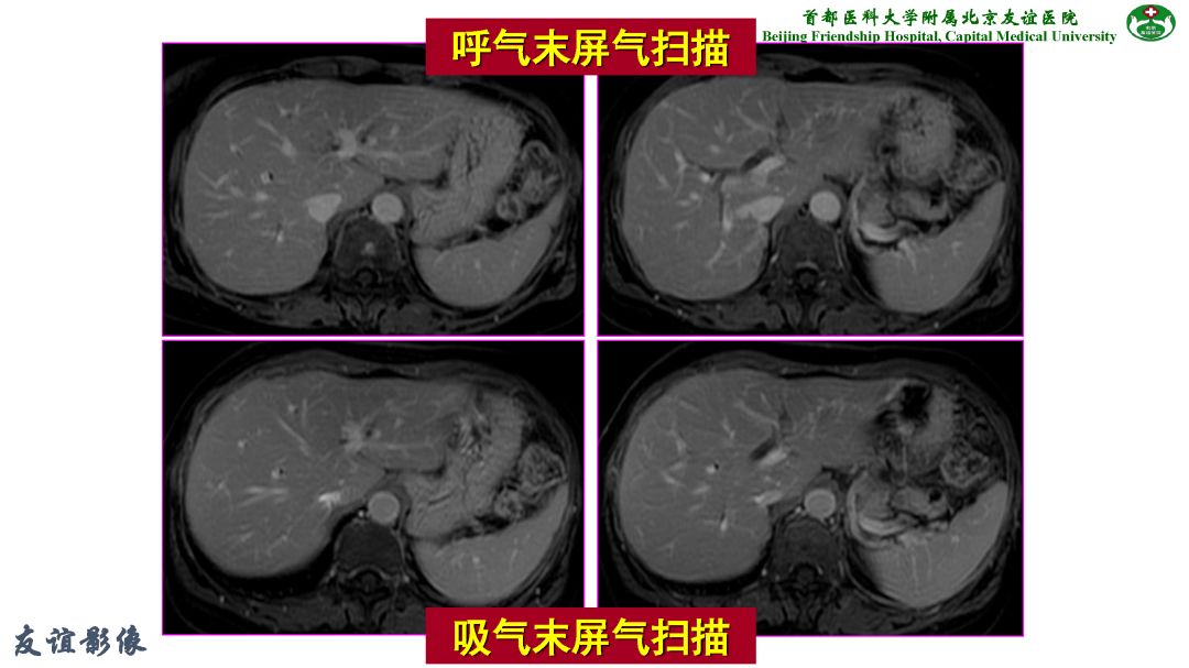 【PPT】肝脏MRI检查技术规范