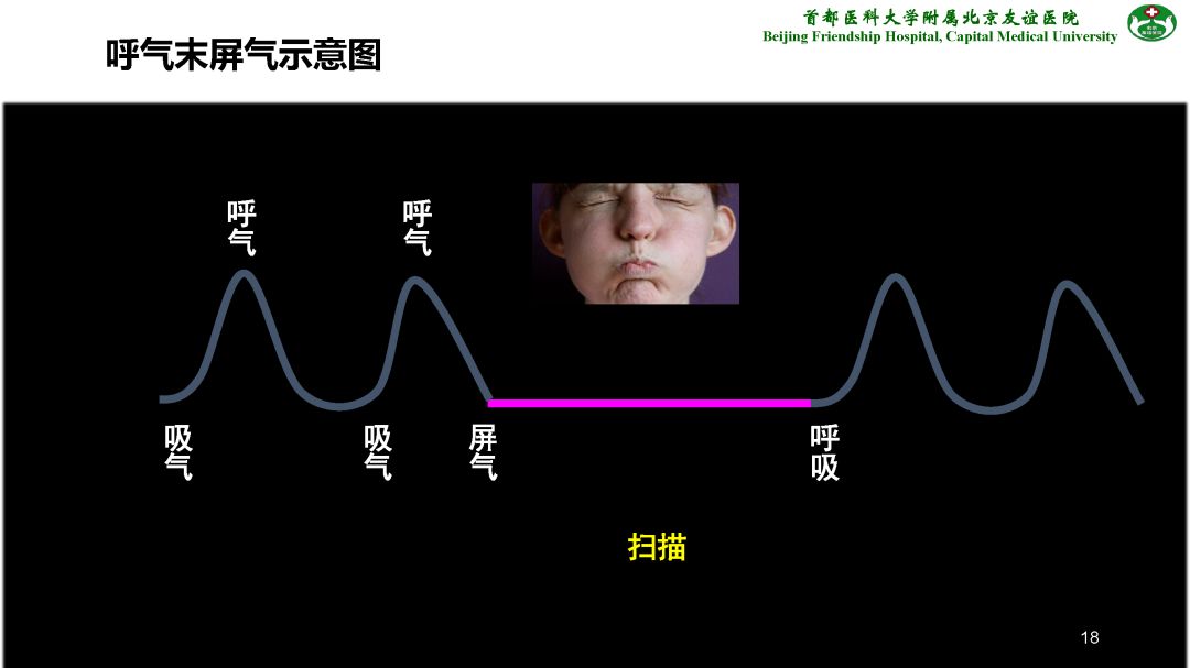 【PPT】肝脏MRI检查技术规范