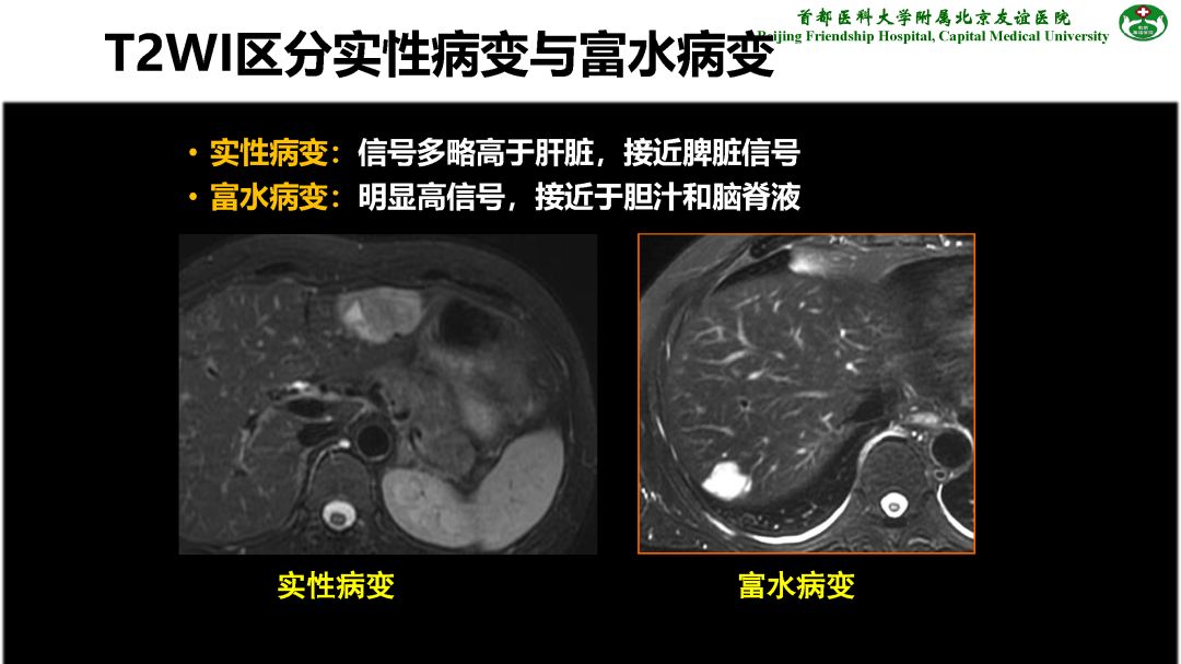 【PPT】肝脏MRI检查技术规范