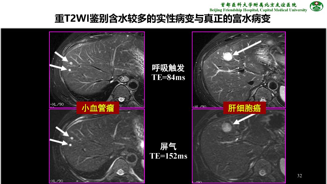 【PPT】肝脏MRI检查技术规范