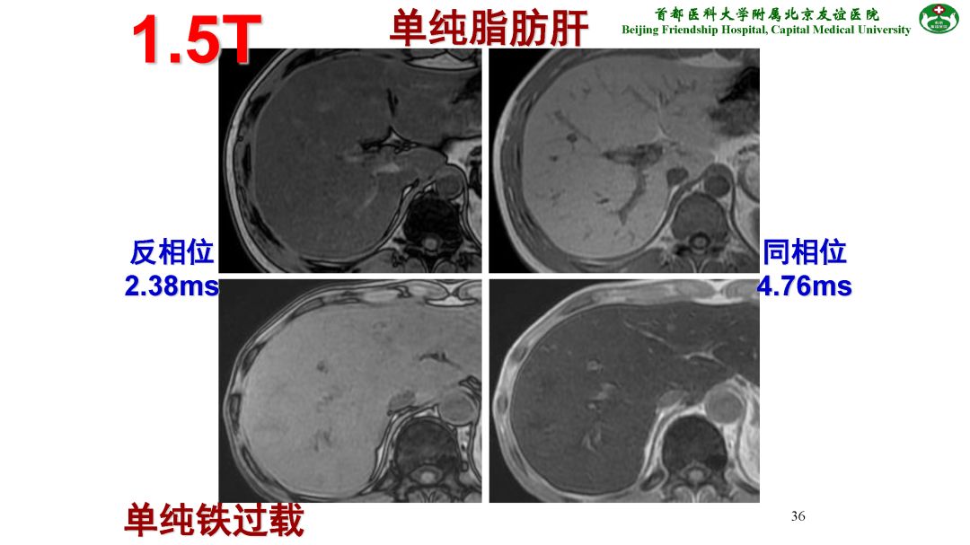 【PPT】肝脏MRI检查技术规范