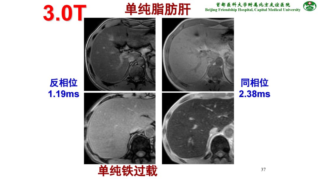 【PPT】肝脏MRI检查技术规范