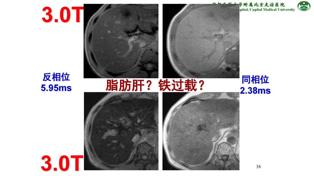 【PPT】肝脏MRI检查技术规范