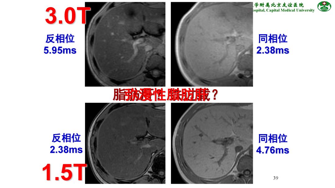 【PPT】肝脏MRI检查技术规范