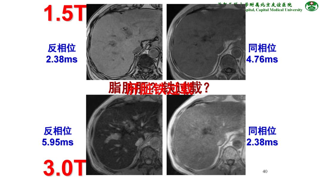 【PPT】肝脏MRI检查技术规范